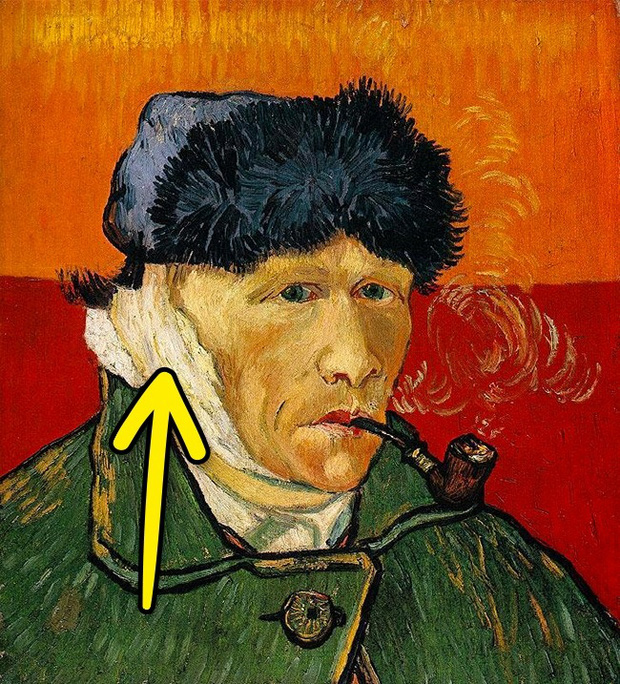 Tai của họa sĩ Van Gogh bị “cắt” sai bên